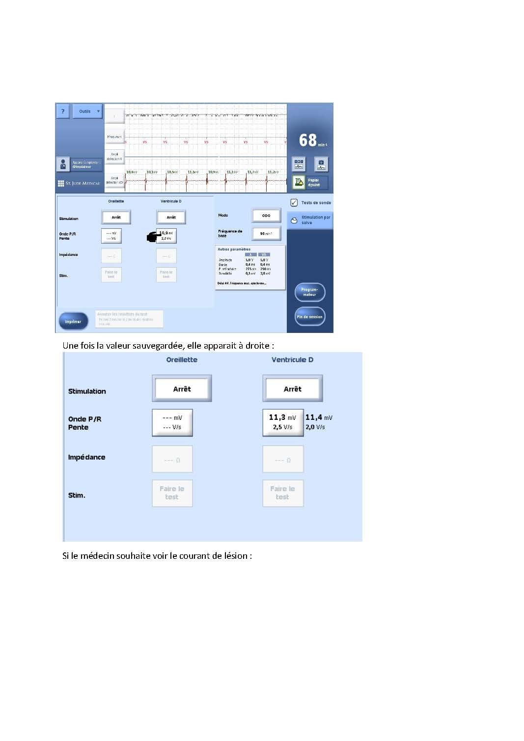 2 2 1 2 fonctionnement des appareils en stimulation cardiaque j les specificites des labos page 02