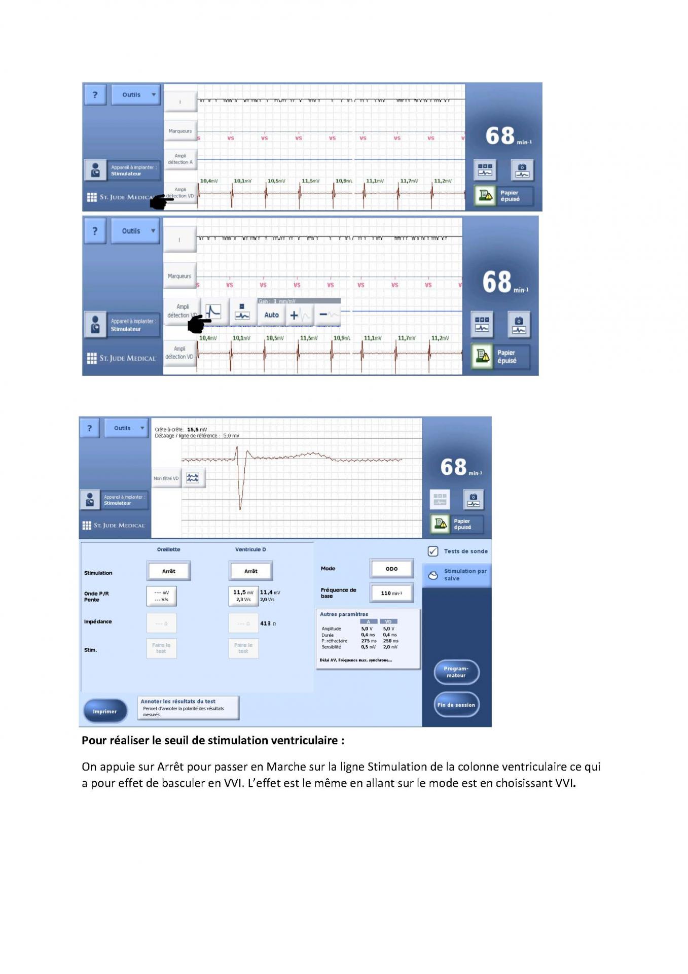2 2 1 2 fonctionnement des appareils en stimulation cardiaque j les specificites des labos page 03