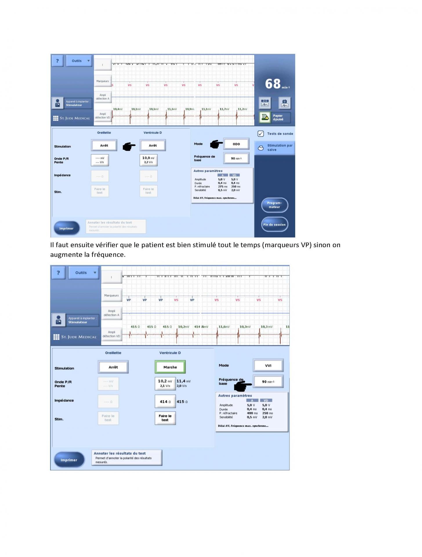 2 2 1 2 fonctionnement des appareils en stimulation cardiaque j les specificites des labos page 04