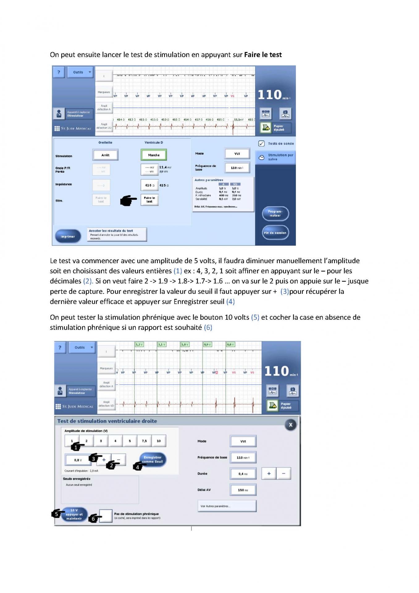 2 2 1 2 fonctionnement des appareils en stimulation cardiaque j les specificites des labos page 05