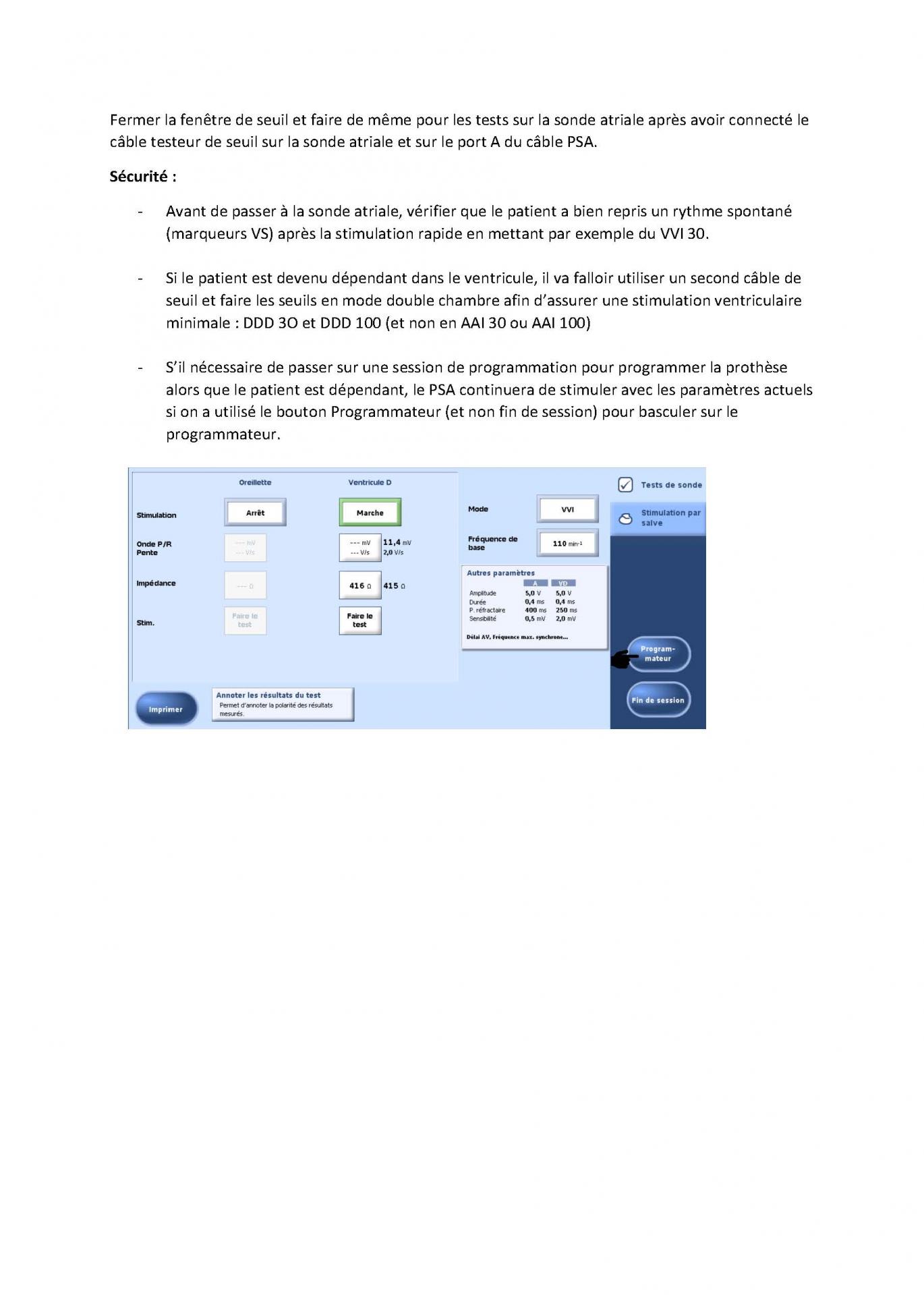 2 2 1 2 fonctionnement des appareils en stimulation cardiaque j les specificites des labos page 06