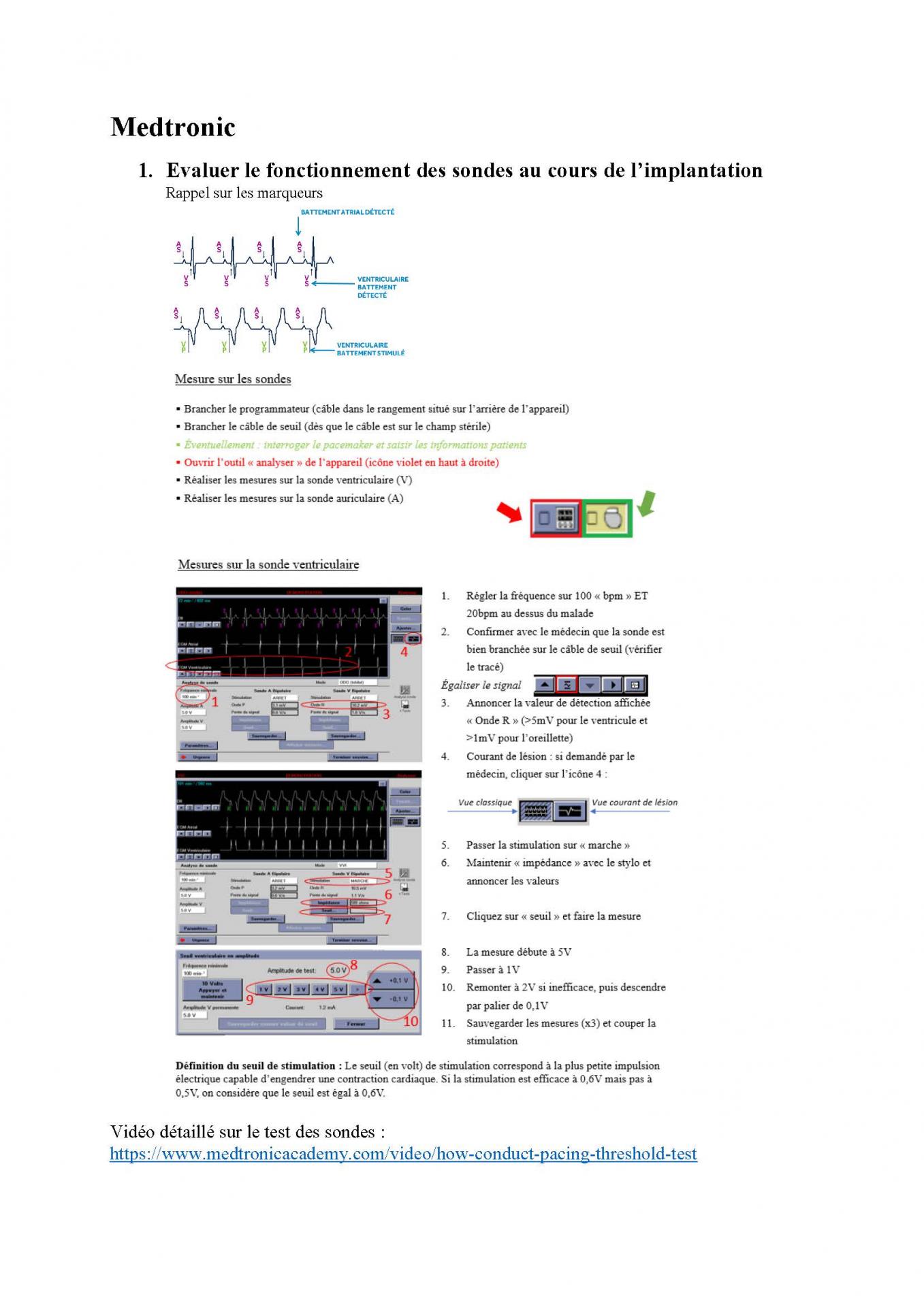 2 2 1 2 fonctionnement des appareils en stimulation cardiaque j les specificites des labos page 08