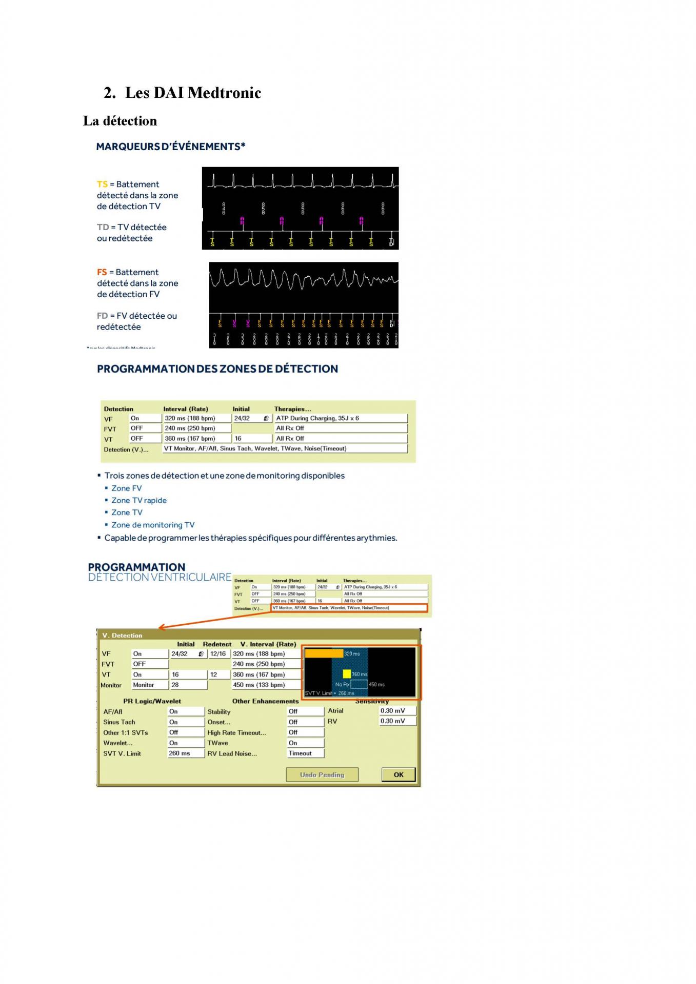 2 2 1 2 fonctionnement des appareils en stimulation cardiaque j les specificites des labos page 09