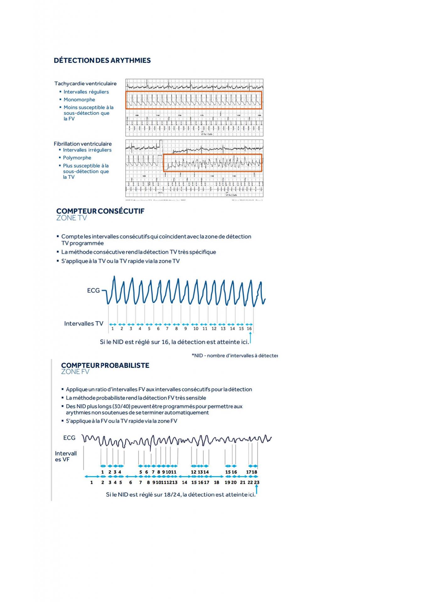 2 2 1 2 fonctionnement des appareils en stimulation cardiaque j les specificites des labos page 10