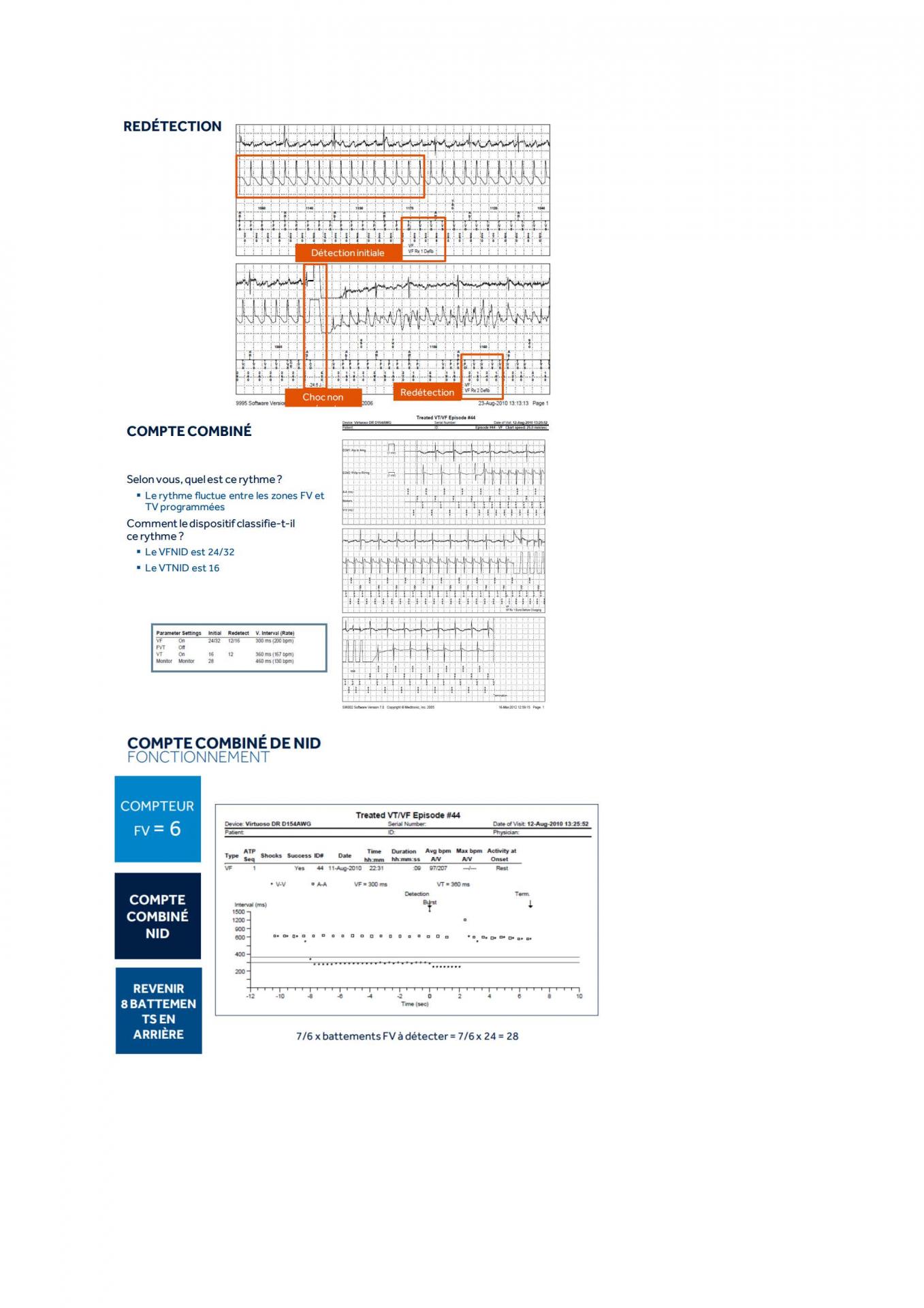 2 2 1 2 fonctionnement des appareils en stimulation cardiaque j les specificites des labos page 11