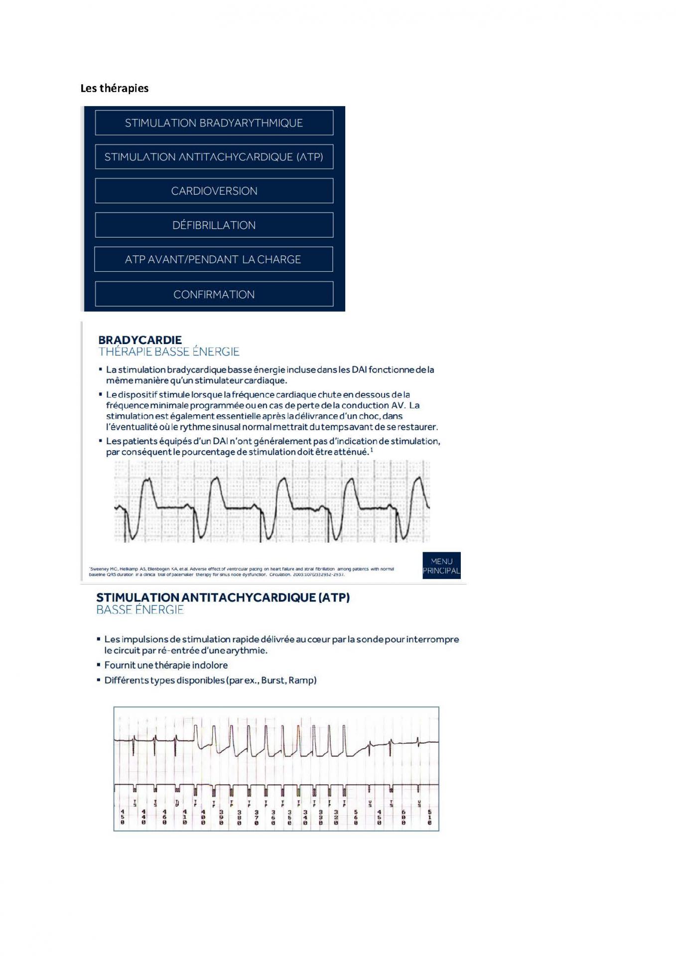 2 2 1 2 fonctionnement des appareils en stimulation cardiaque j les specificites des labos page 13