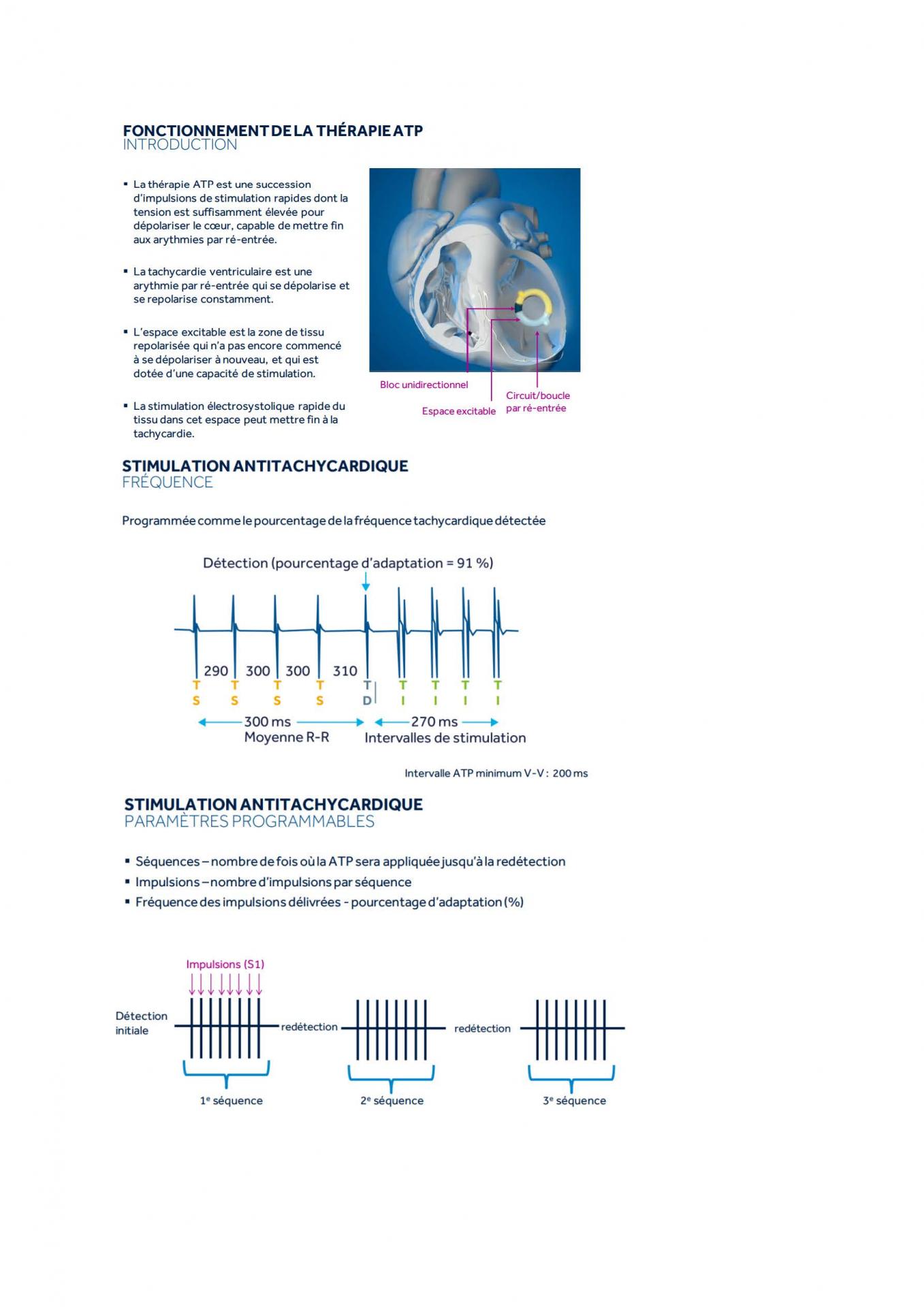 2 2 1 2 fonctionnement des appareils en stimulation cardiaque j les specificites des labos page 14