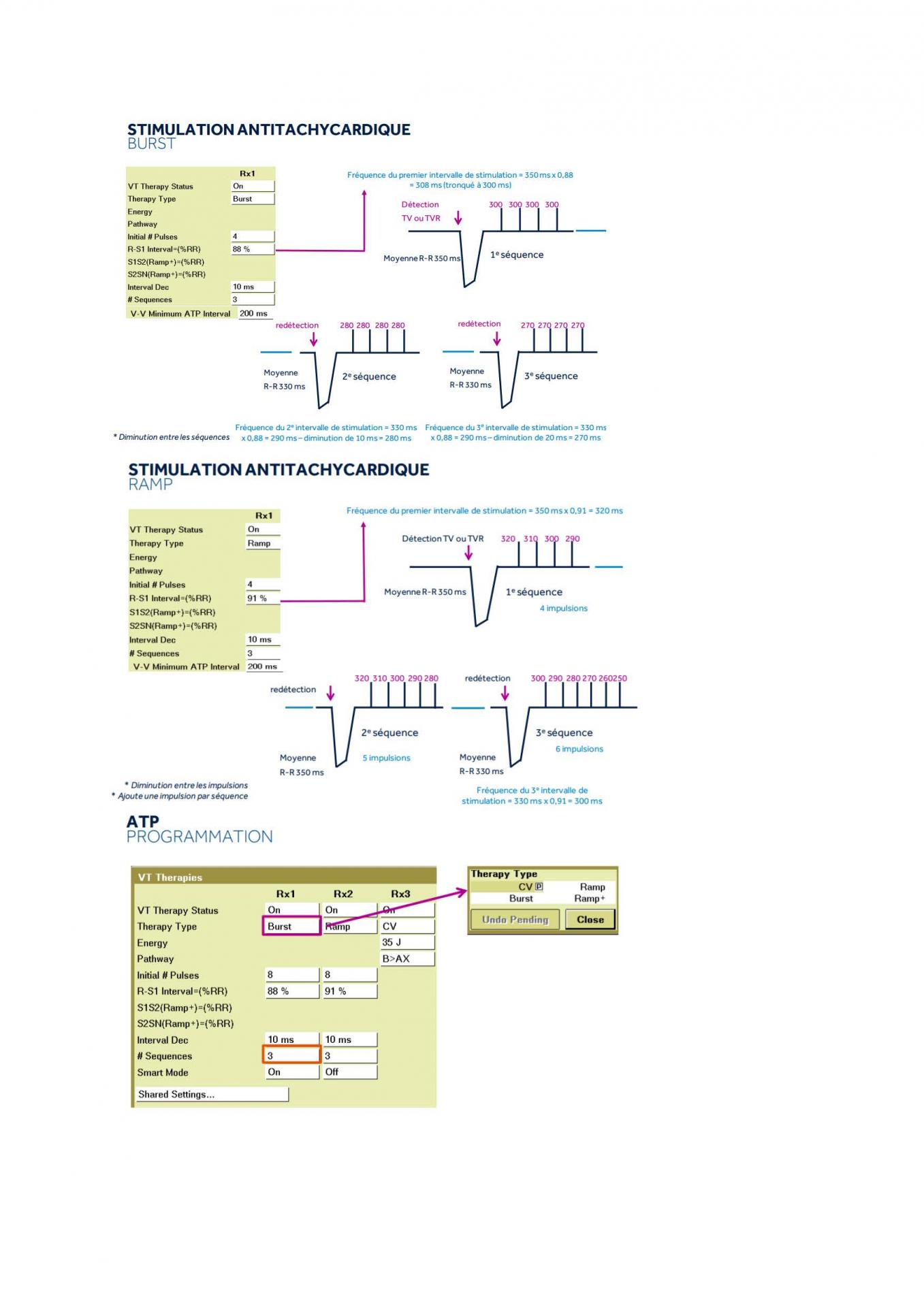 2 2 1 2 fonctionnement des appareils en stimulation cardiaque j les specificites des labos page 15