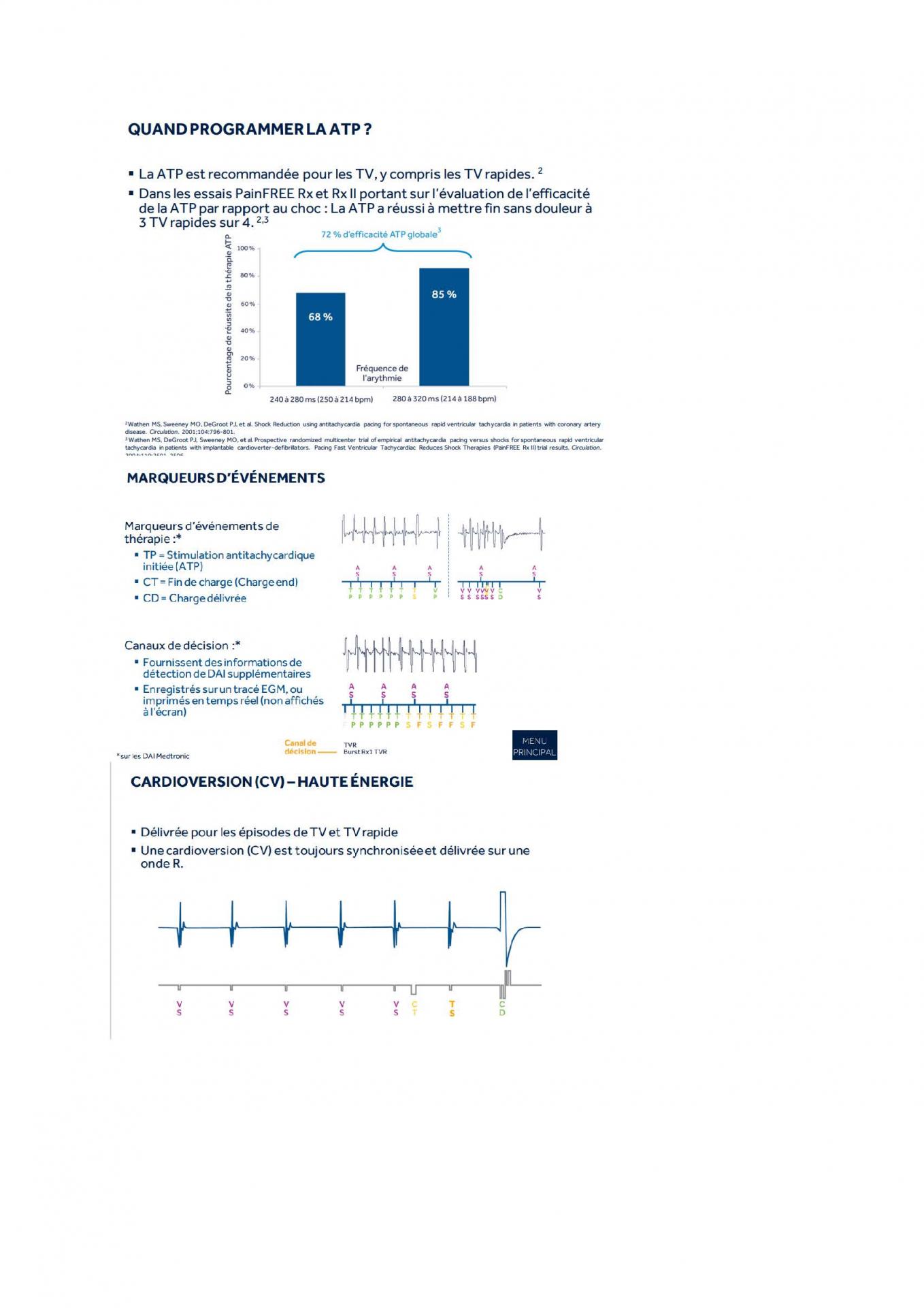 2 2 1 2 fonctionnement des appareils en stimulation cardiaque j les specificites des labos page 16