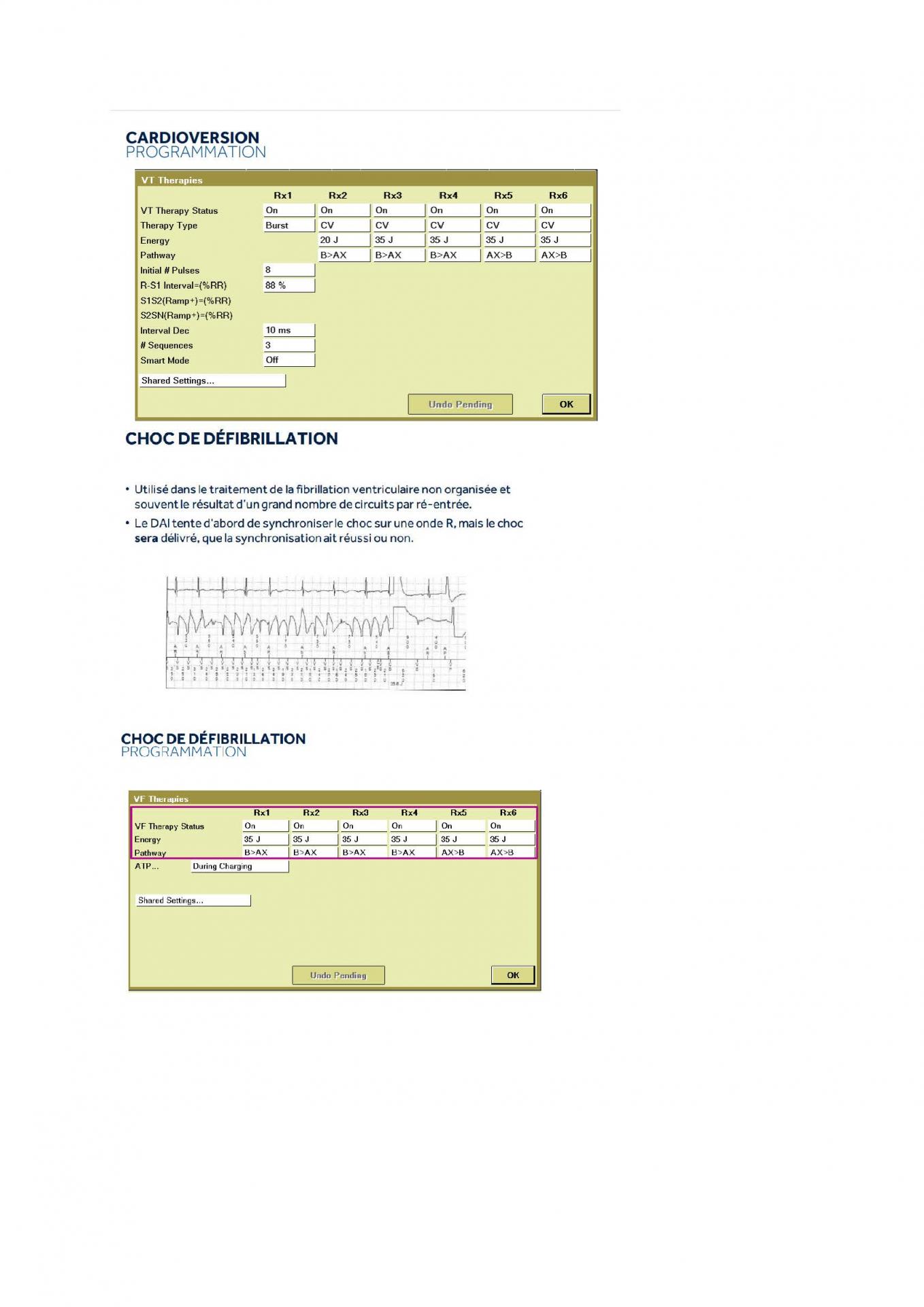 2 2 1 2 fonctionnement des appareils en stimulation cardiaque j les specificites des labos page 17