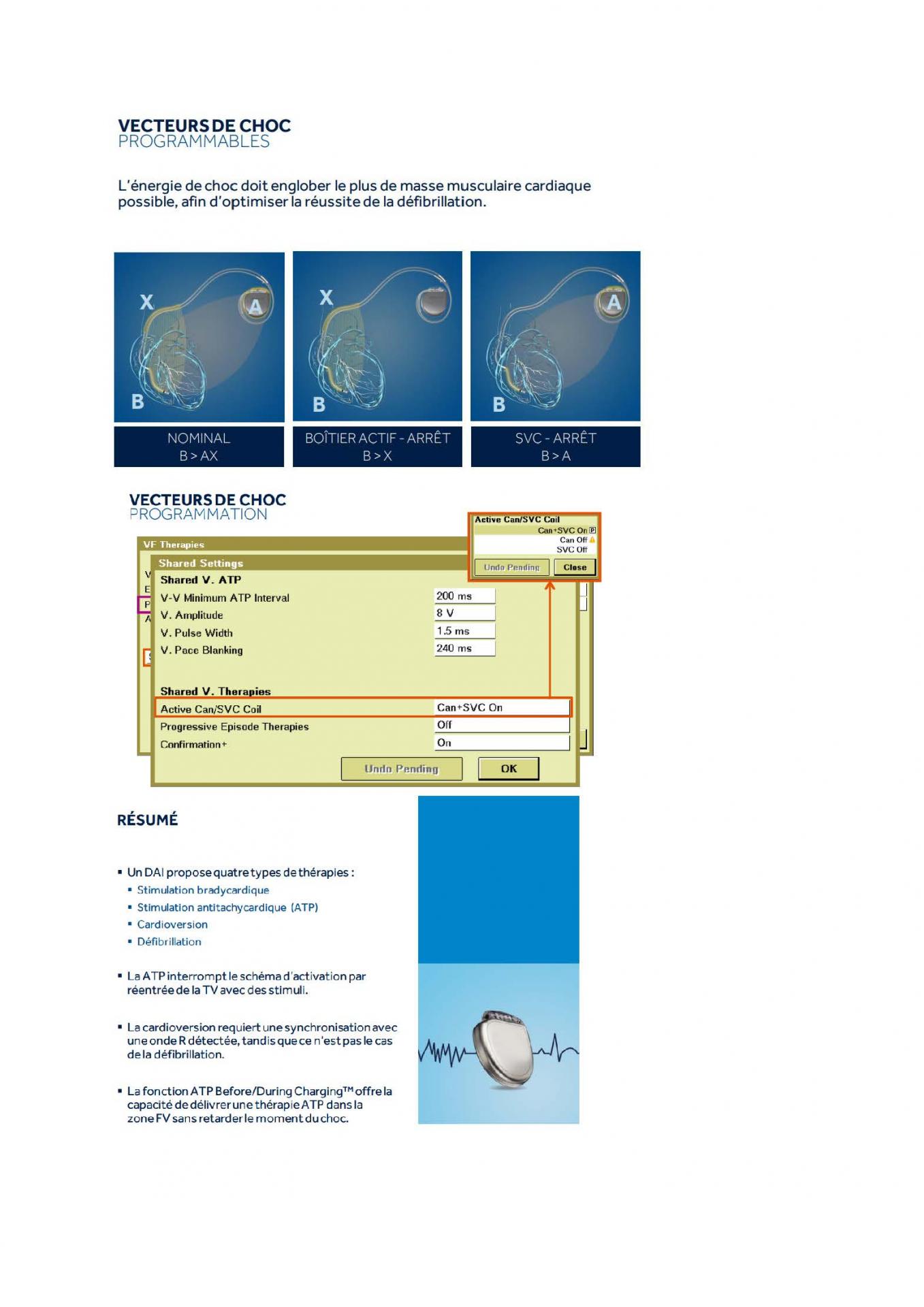 2 2 1 2 fonctionnement des appareils en stimulation cardiaque j les specificites des labos page 18