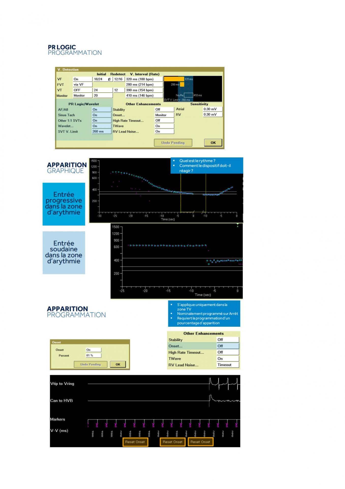 2 2 1 2 fonctionnement des appareils en stimulation cardiaque j les specificites des labos page 20