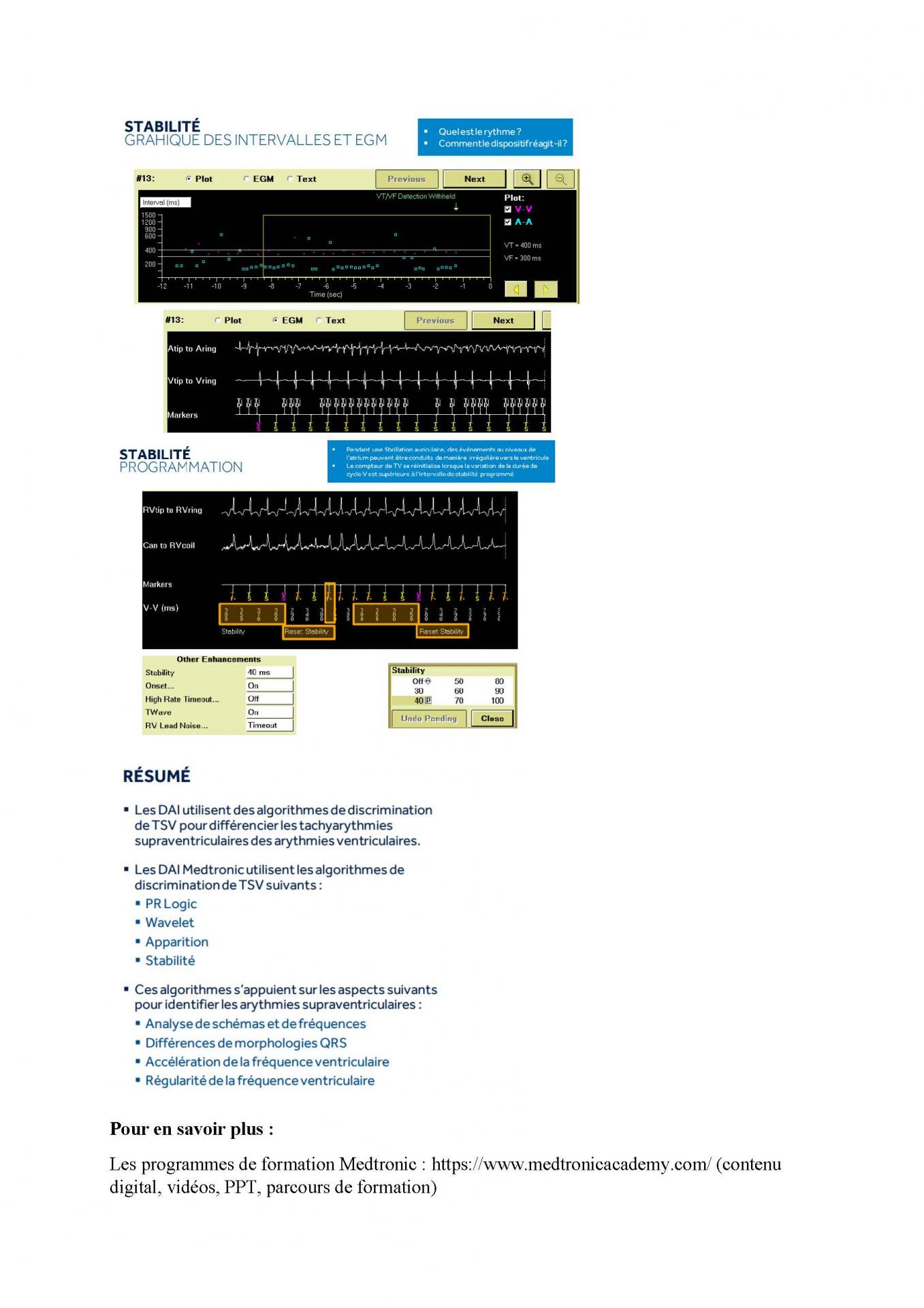 2 2 1 2 fonctionnement des appareils en stimulation cardiaque j les specificites des labos page 21