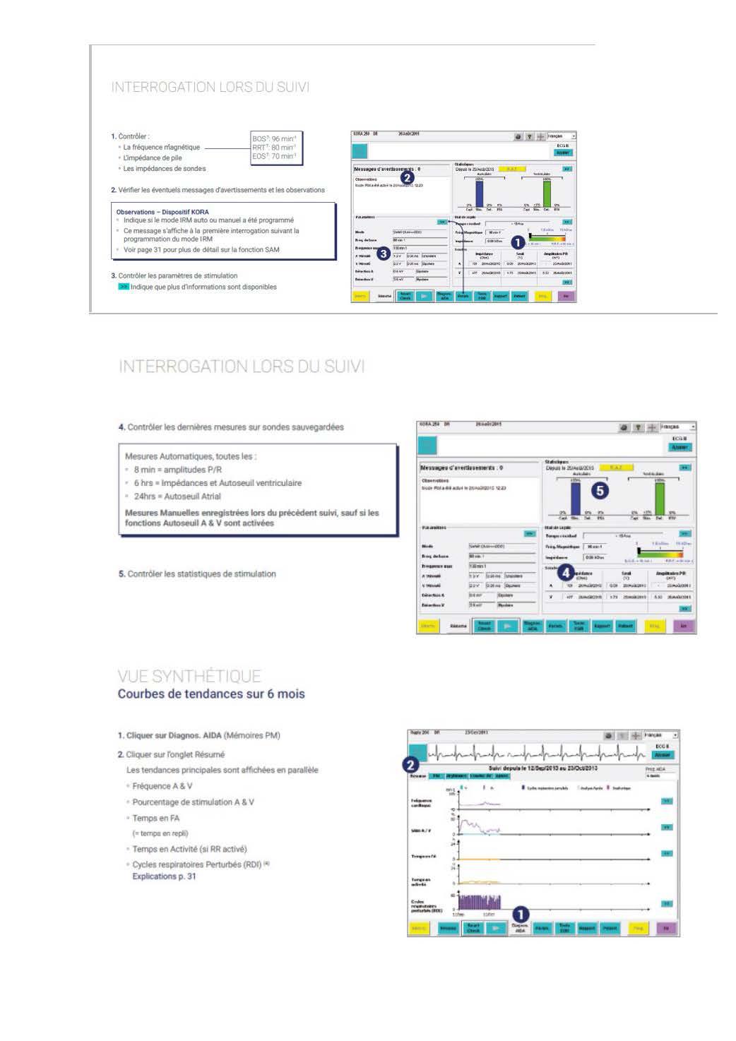 2 2 1 2 fonctionnement des appareils en stimulation cardiaque les specificites des labos copie page 02