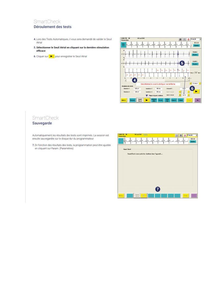 2 2 1 2 fonctionnement des appareils en stimulation cardiaque les specificites des labos copie page 04