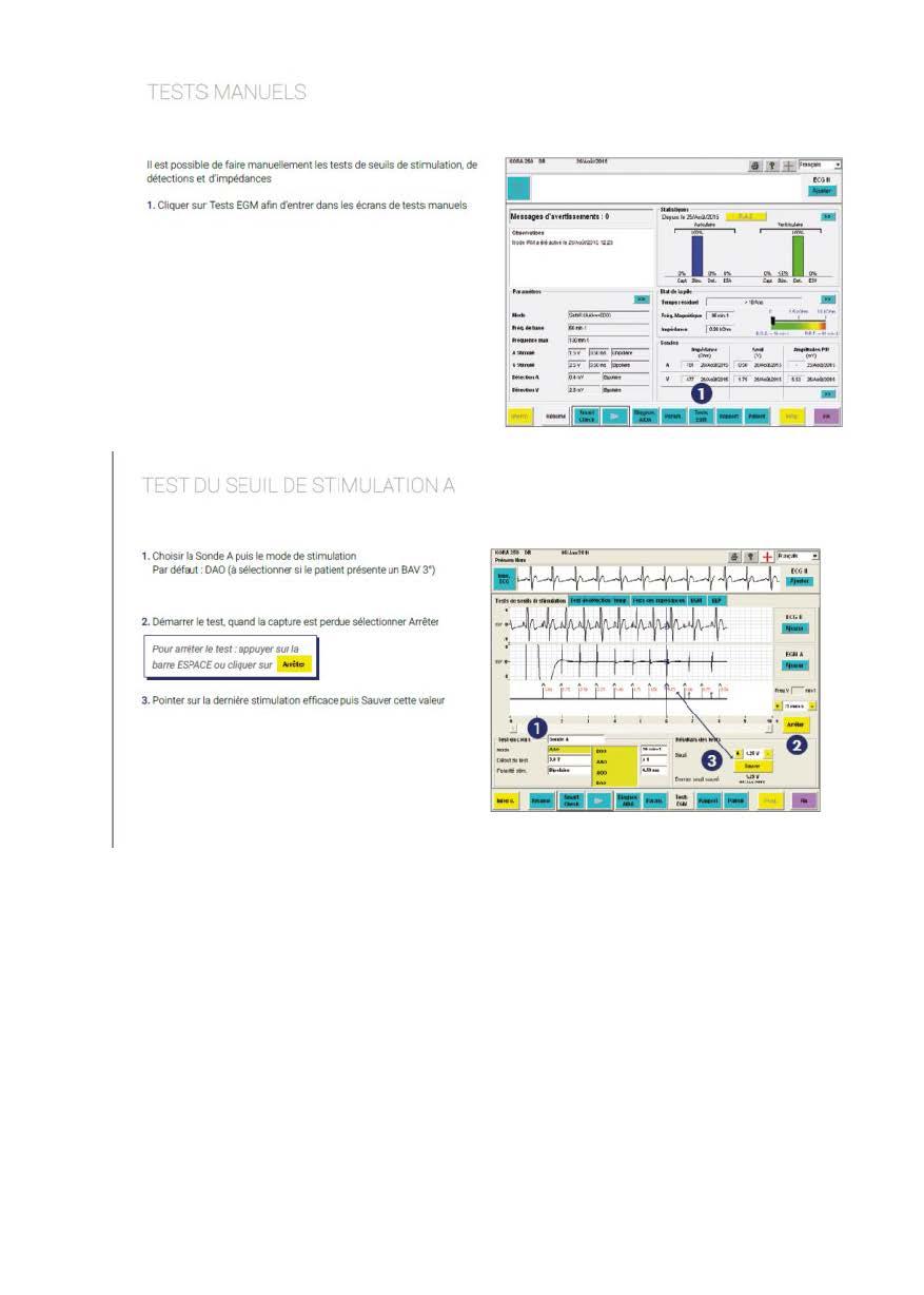 Microport Log Microport : Utilisation du programmateur, stimulateurs cardiaques et ...