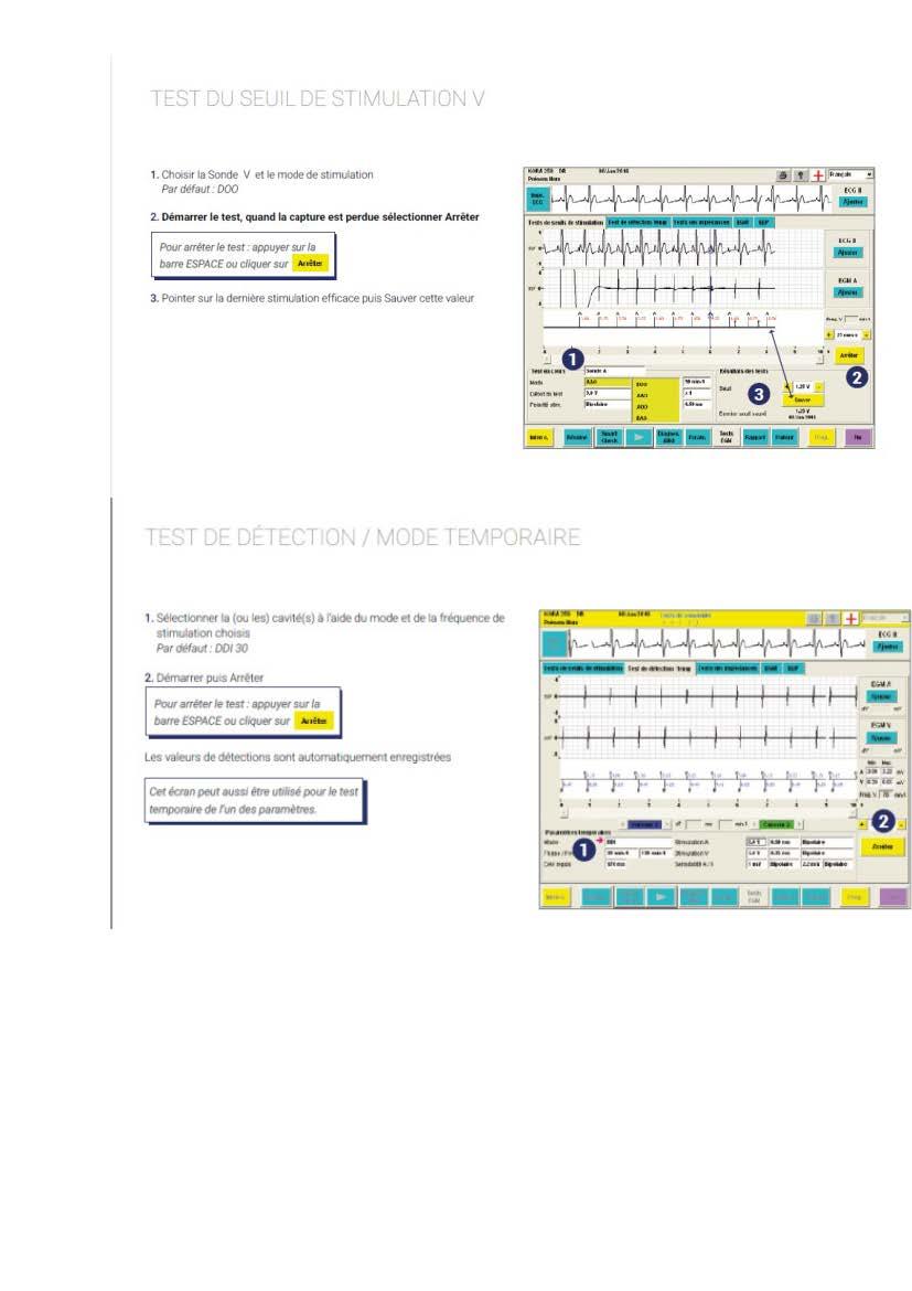 2 2 1 2 fonctionnement des appareils en stimulation cardiaque les specificites des labos copie page 06