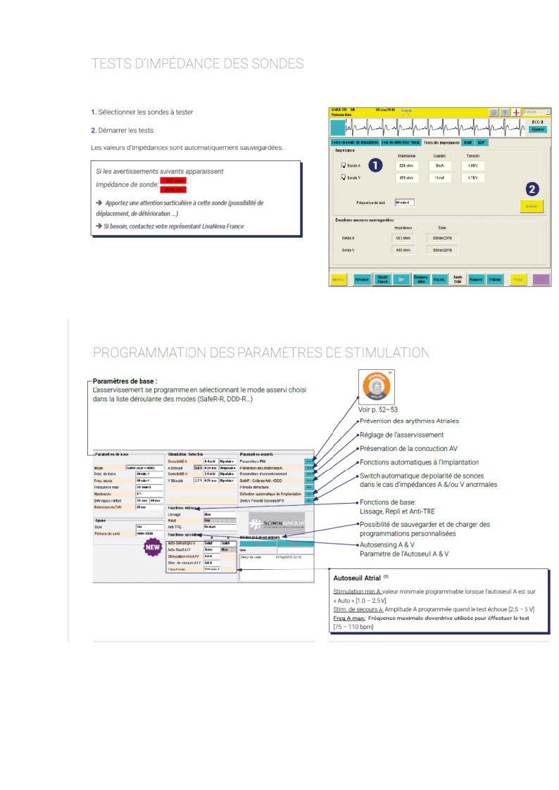 2 2 1 2 fonctionnement des appareils en stimulation cardiaque les specificites des labos copie page 07