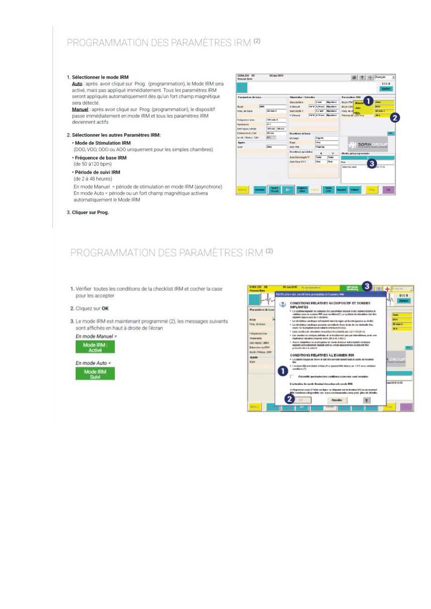 2 2 1 2 fonctionnement des appareils en stimulation cardiaque les specificites des labos copie page 09