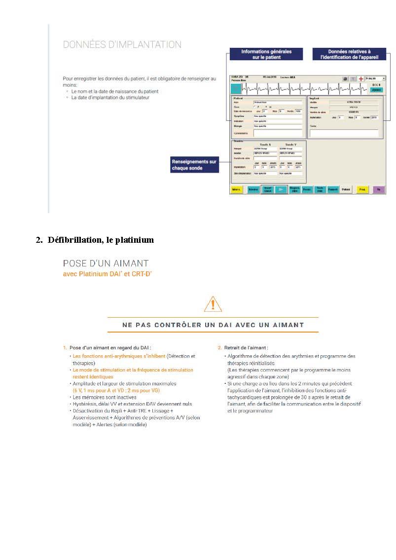 2 2 1 2 fonctionnement des appareils en stimulation cardiaque les specificites des labos copie page 10