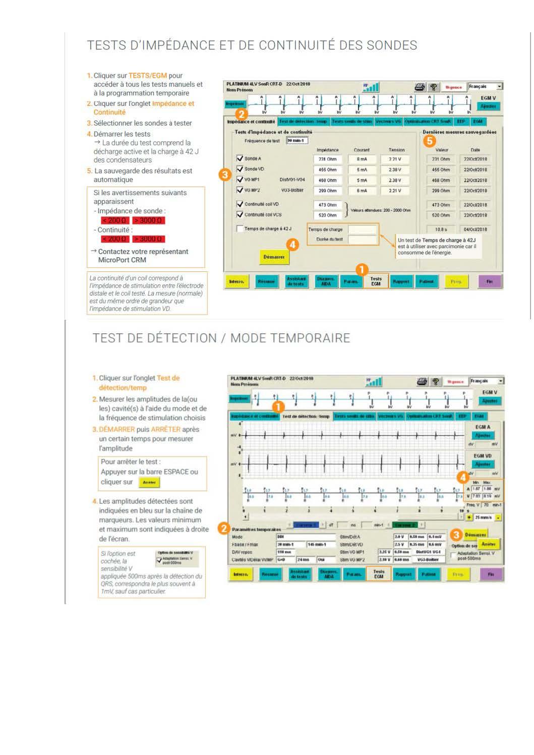 2 2 1 2 fonctionnement des appareils en stimulation cardiaque les specificites des labos copie page 13