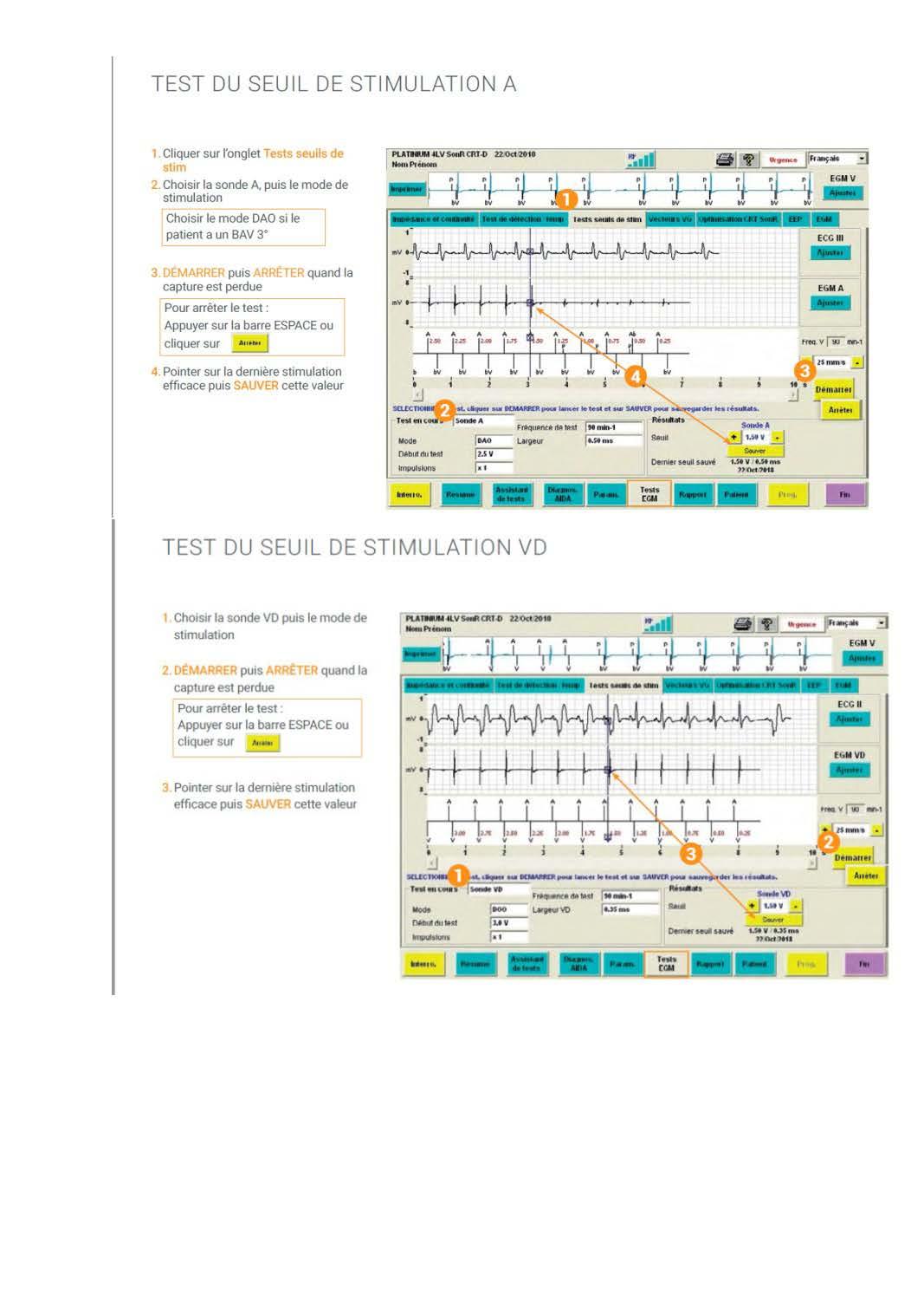 2 2 1 2 fonctionnement des appareils en stimulation cardiaque les specificites des labos copie page 14