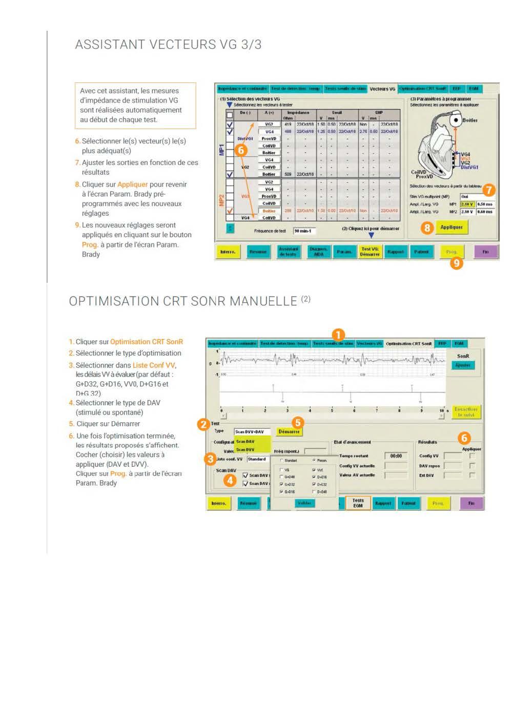 Microport Log Microport : Utilisation du programmateur, stimulateurs cardiaques et ...