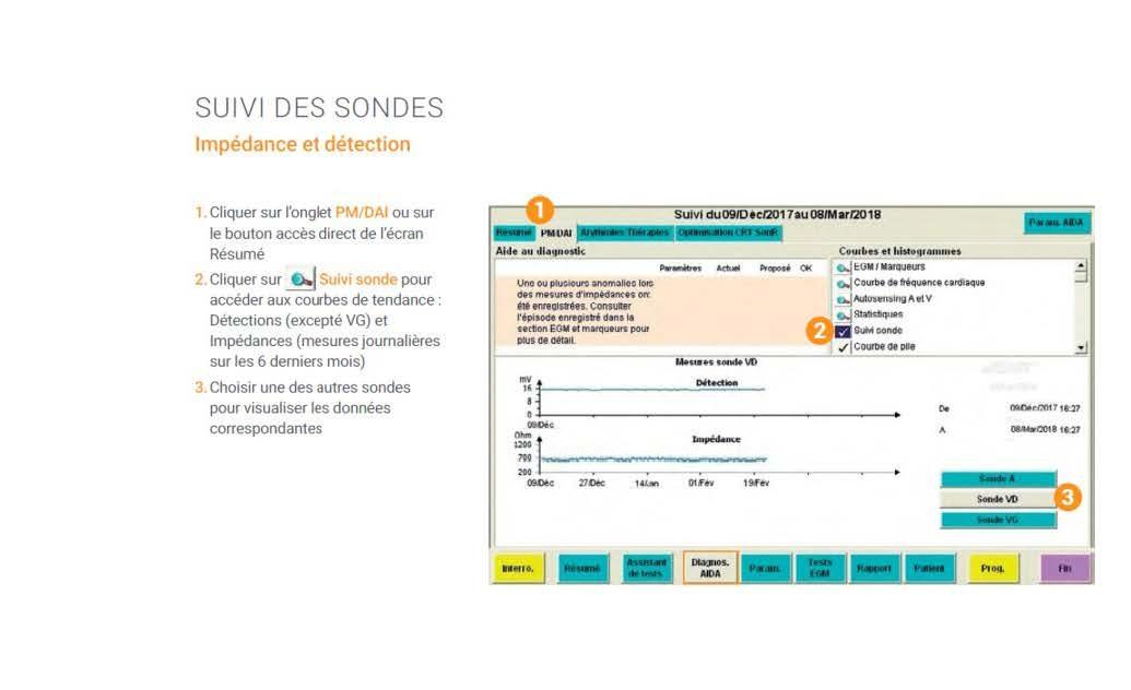 Microport Log Microport : Utilisation du programmateur, stimulateurs cardiaques et ...