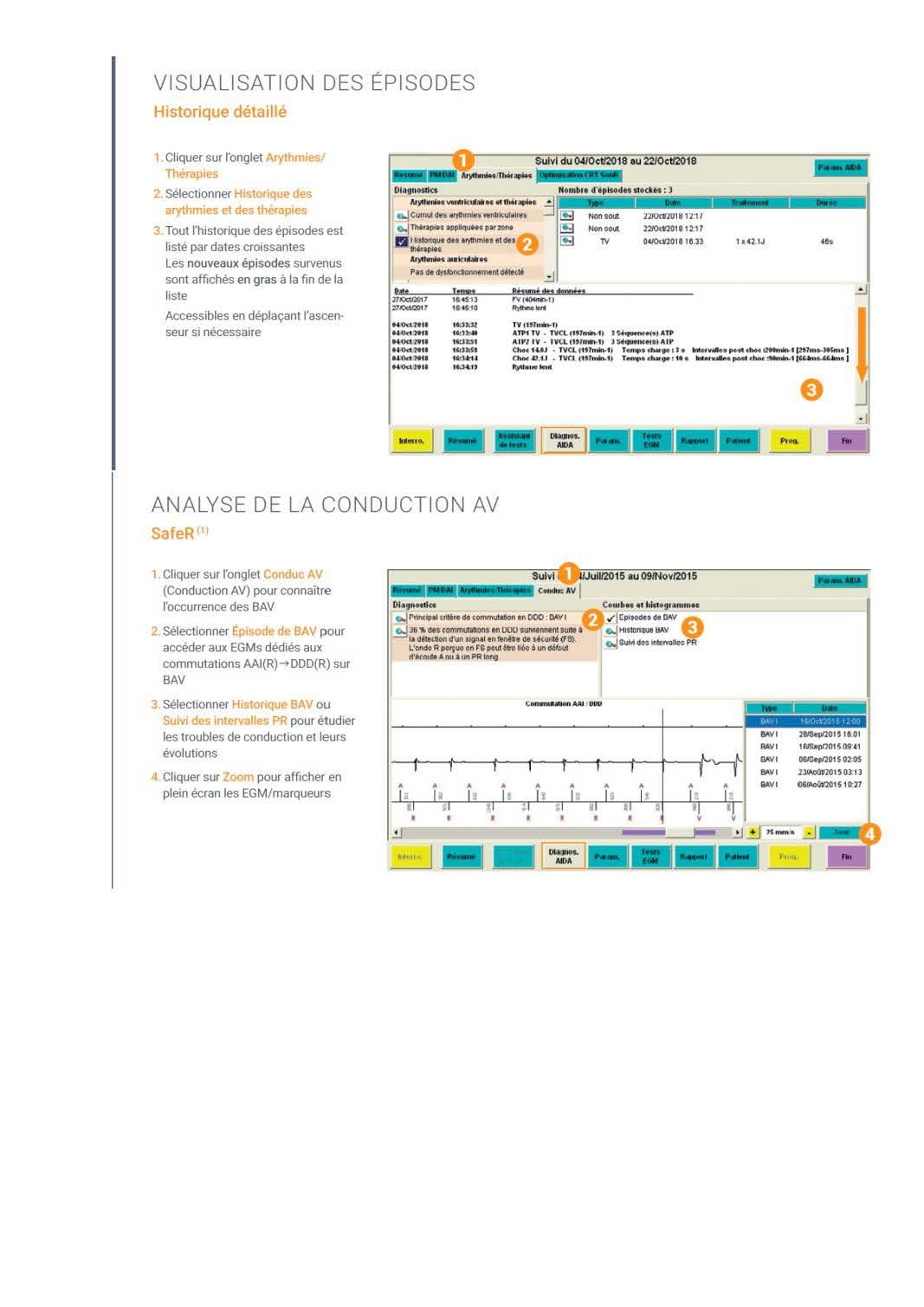 Microport Log Microport : Utilisation du programmateur, stimulateurs cardiaques et ...