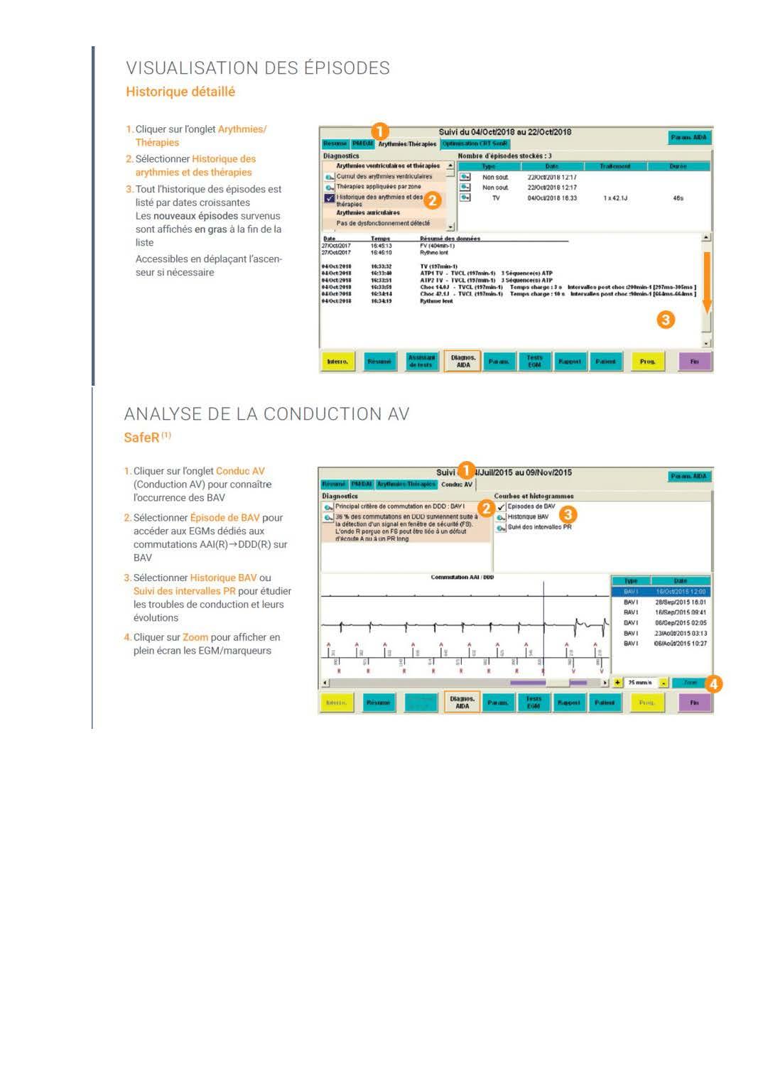 2 2 1 2 fonctionnement des appareils en stimulation cardiaque les specificites des labos copie page 20