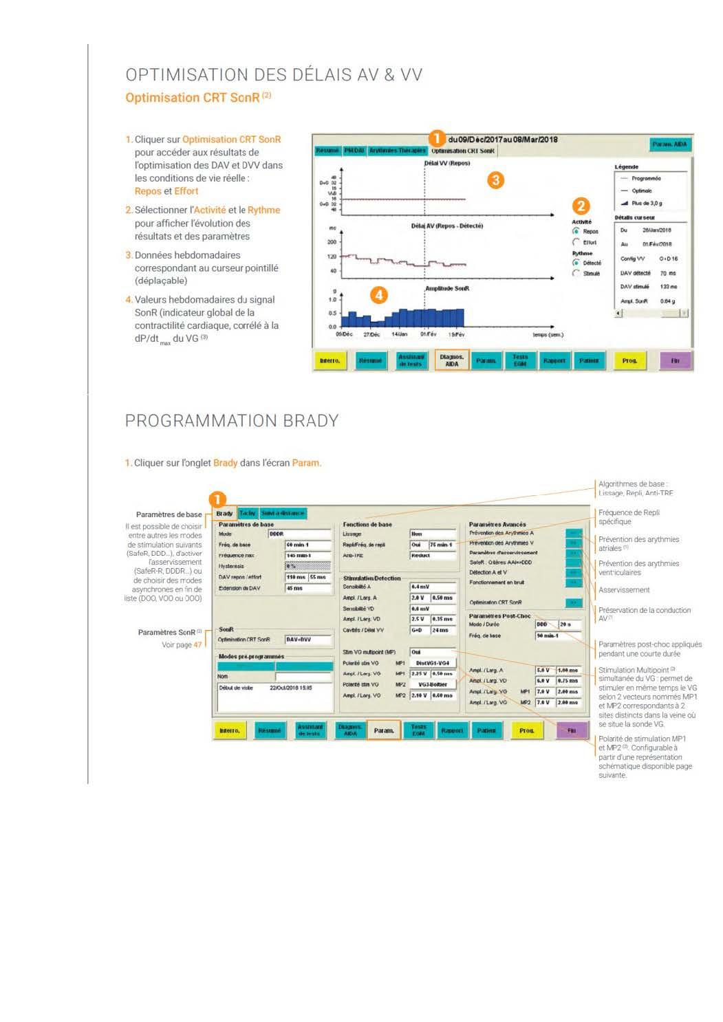 2 2 1 2 fonctionnement des appareils en stimulation cardiaque les specificites des labos copie page 21