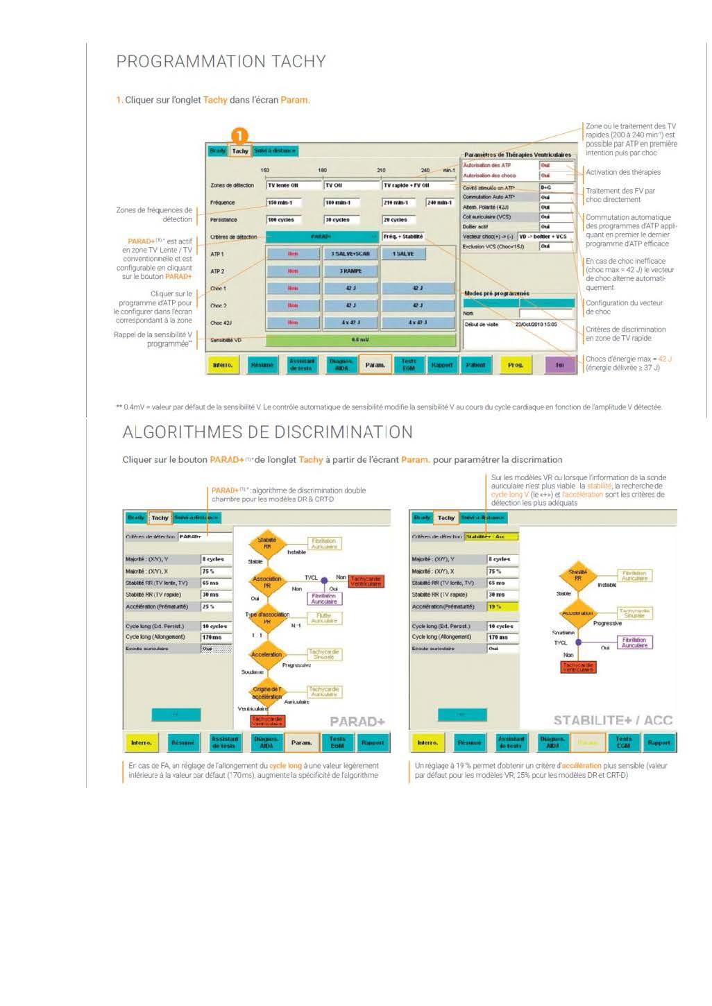 2 2 1 2 fonctionnement des appareils en stimulation cardiaque les specificites des labos copie page 23