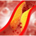 Cholesterol