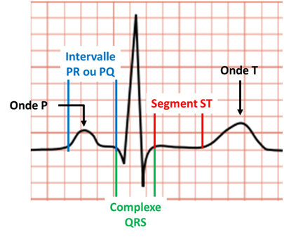 Ecg 1