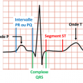 Ecg 1