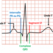 Ecg 1