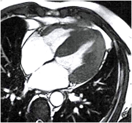 Ett cmh 1