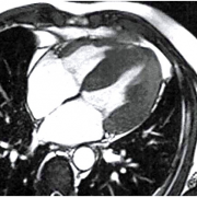 Ett cmh