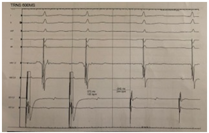 Fig 5 1eep