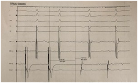 Fig 5 2 eep