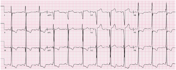 Fig 1 cmh