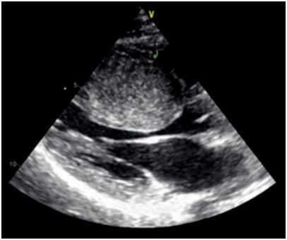 Fig 2 cmh