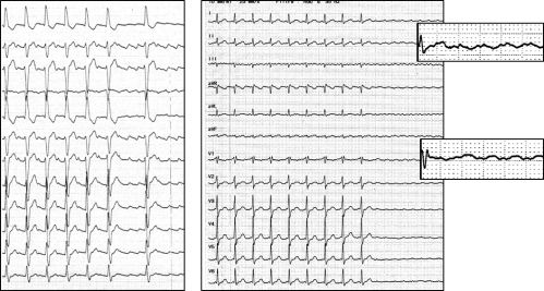 Fig 4 flutter 12d