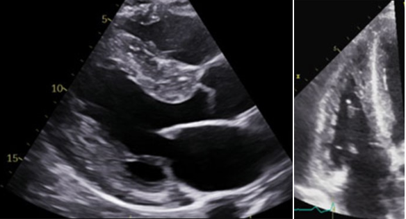 Fig 4 cmh