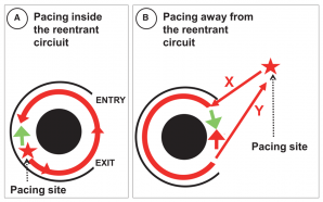 Fig 6 flutter entrainement