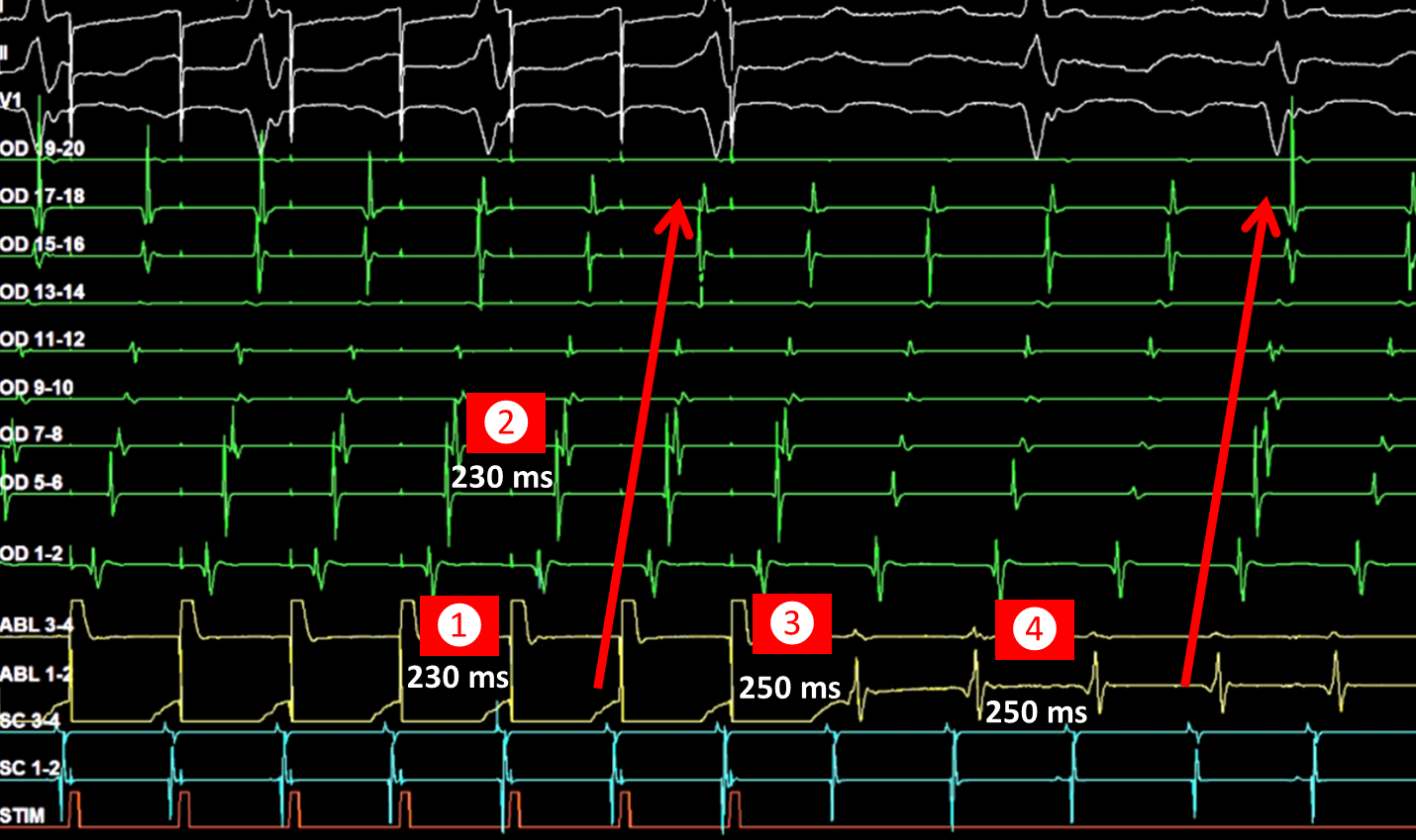 Fig 7 flutter horaire entrainement