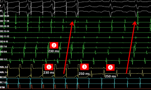 Fig 7 flutter horaire entrainement