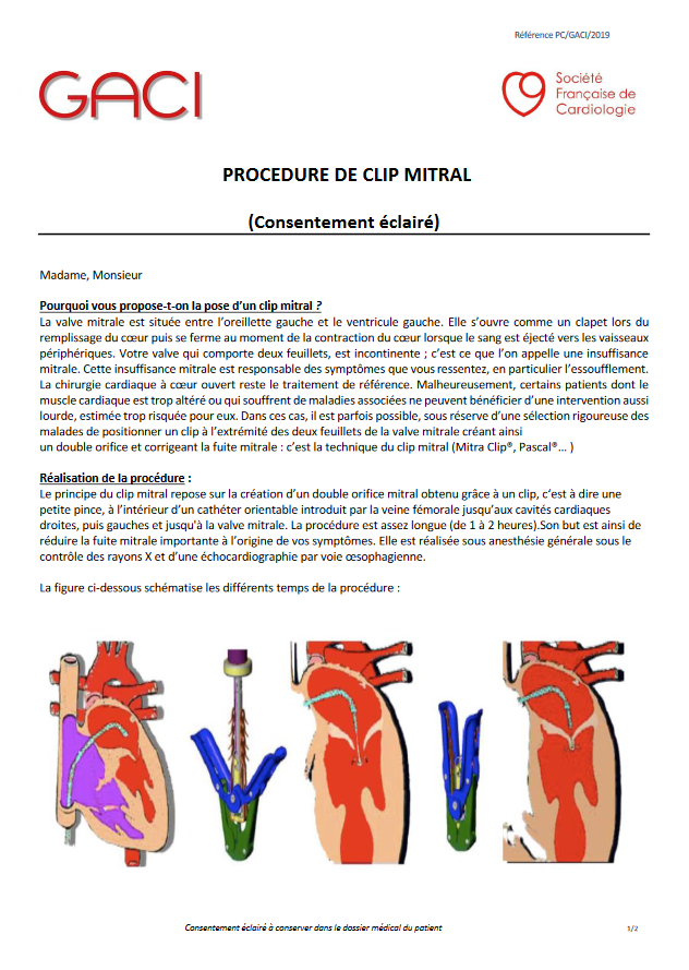 Mitraclip