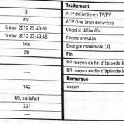 Que peut-on dire de ce rapport et tracé de télécardiologie :