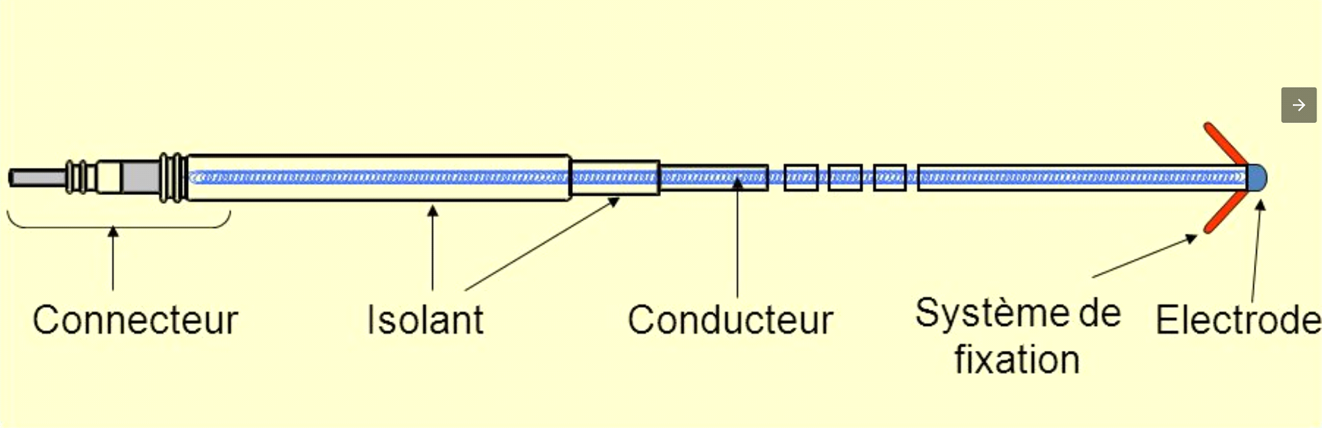 Stim 1 2